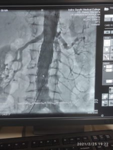 stent-surgery-web
