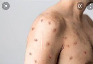 Screenshot_20220729-214930_Google